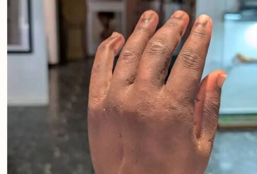Nigerian inventor’s bionic arm named among TIME’s best inventions of 2026