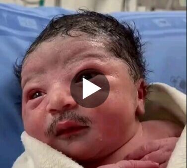 “Senior Man Baby”- Reactions As Baby Born With Full Blown Moustache Goes Viral