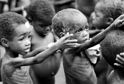 Nigeria, US Organisation To Tackle Child Malnutrition